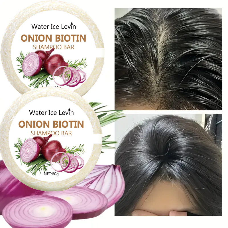 Onion & Biotin Shampoo Bar - 6 - Biotin Hair Growth avis et prix