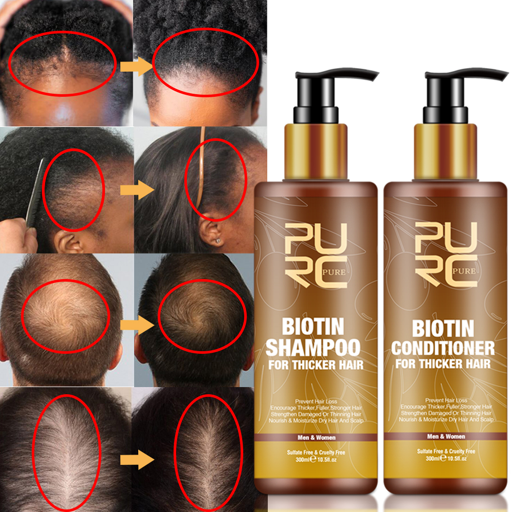 PURC Smoothing Hair Scalp Trea - Biotin Hair Growth avis et prix
